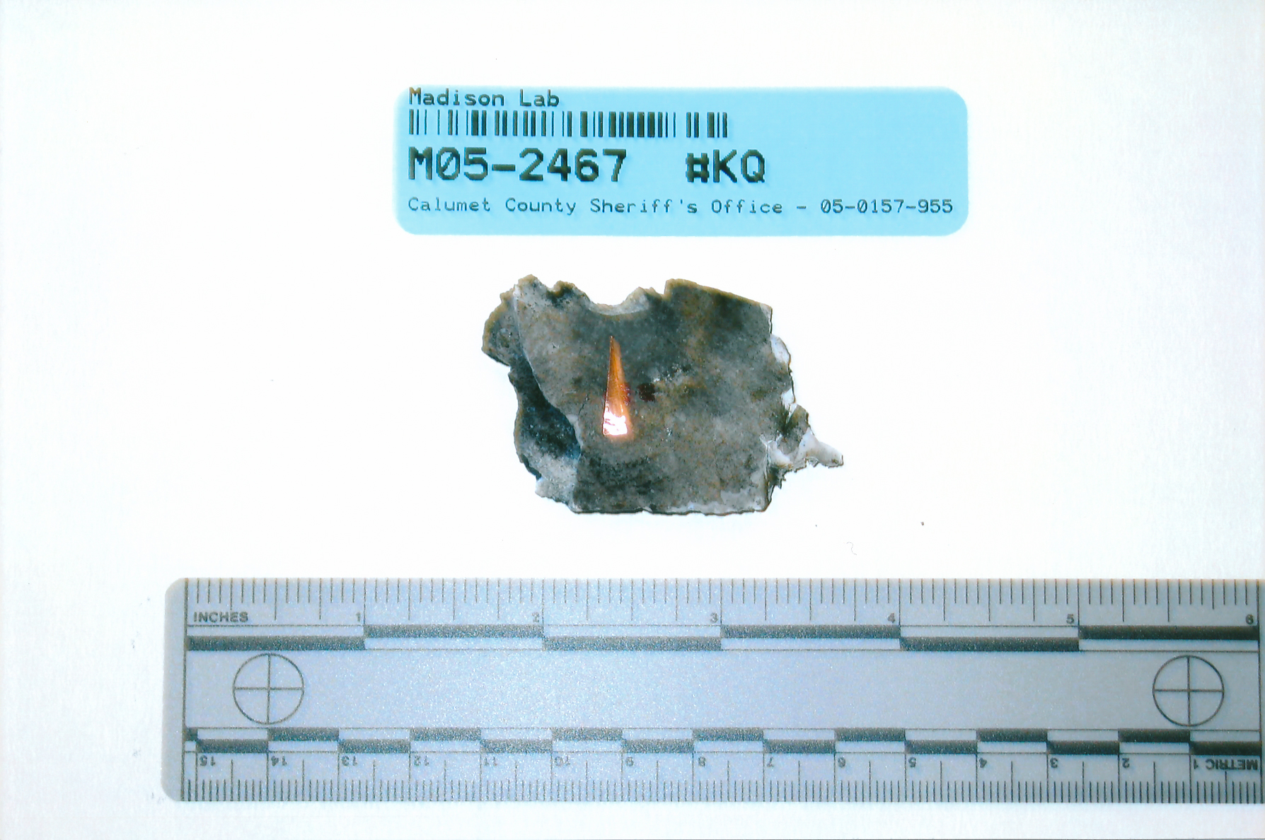 exhibit-429-cranial-bone-fragments-outer-defect